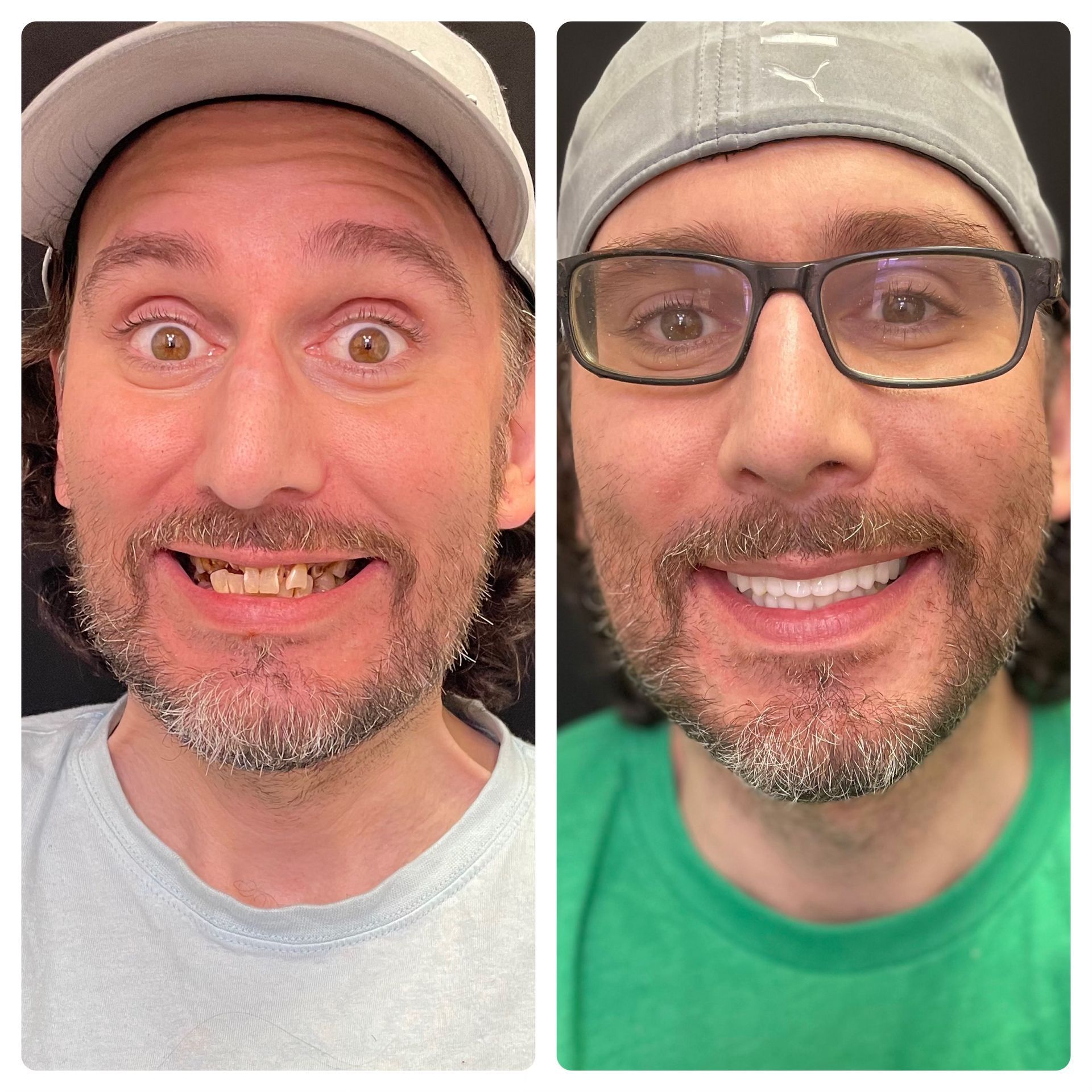 before and afters