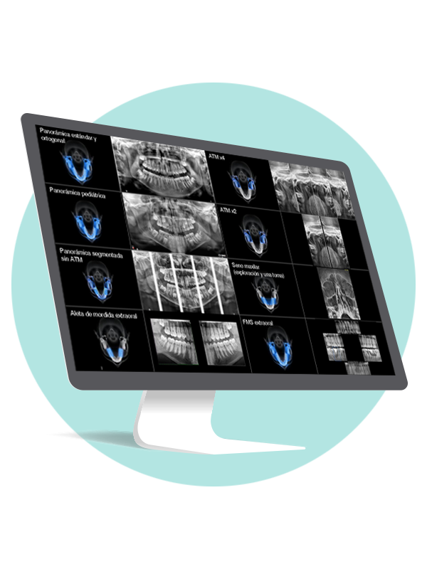 Radiología Extraorales