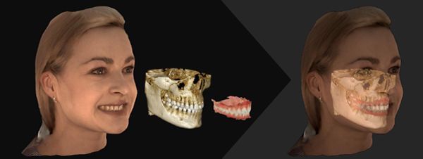 CS Face Scan