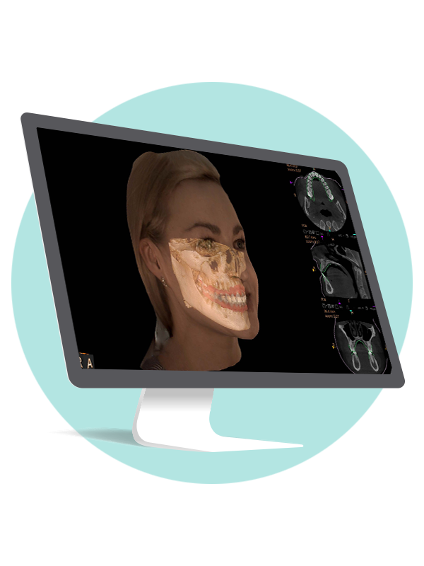 CS Face Scan