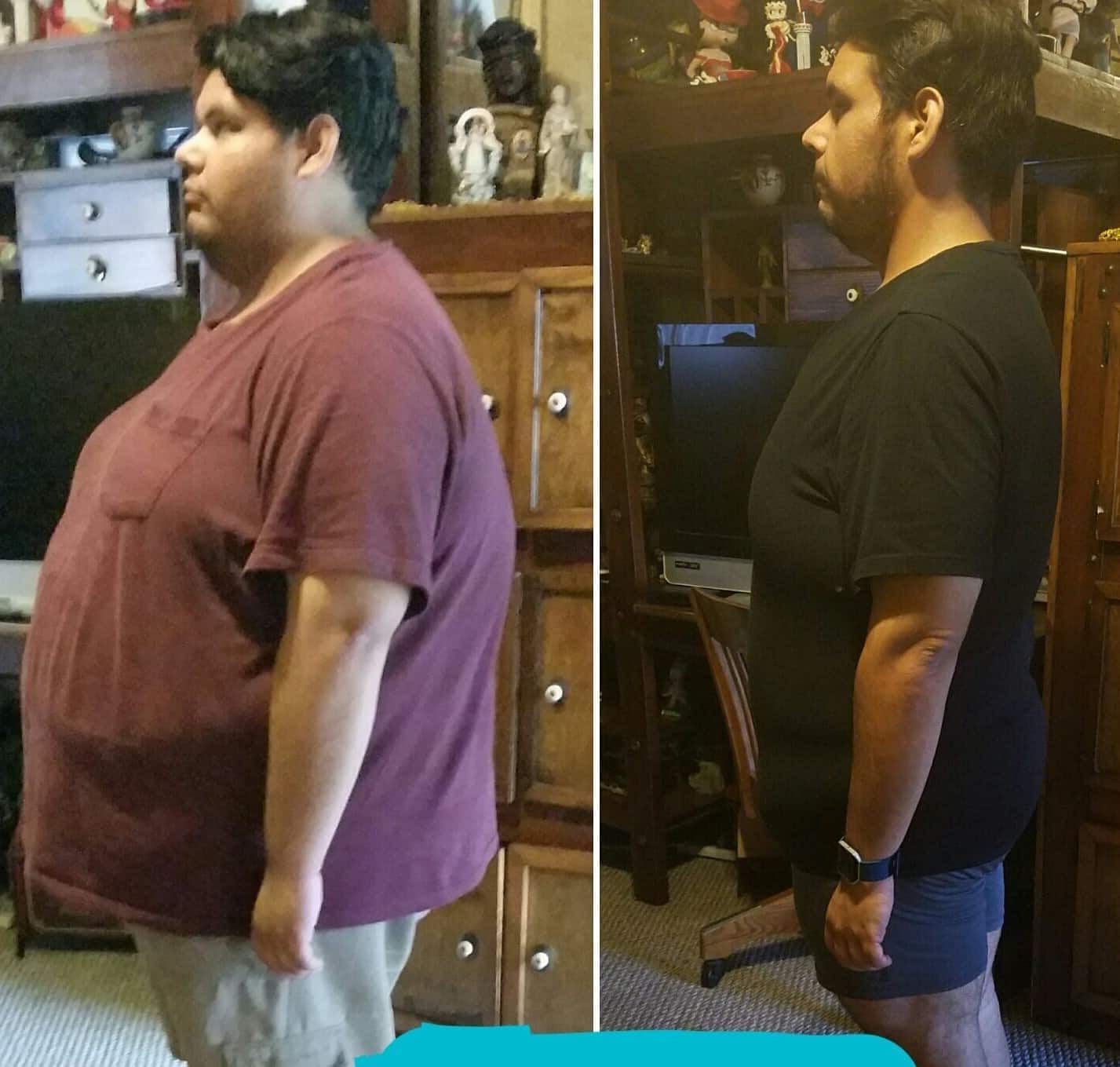 before and after