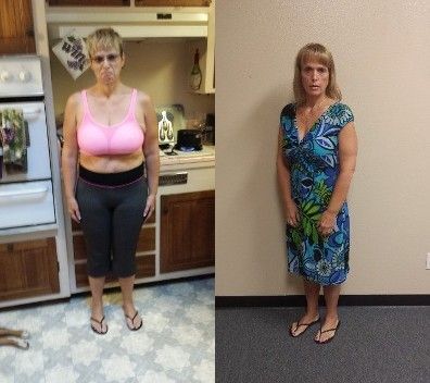 before and after