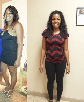 before and after