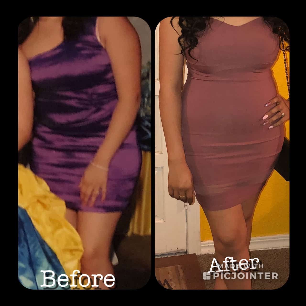 before and after