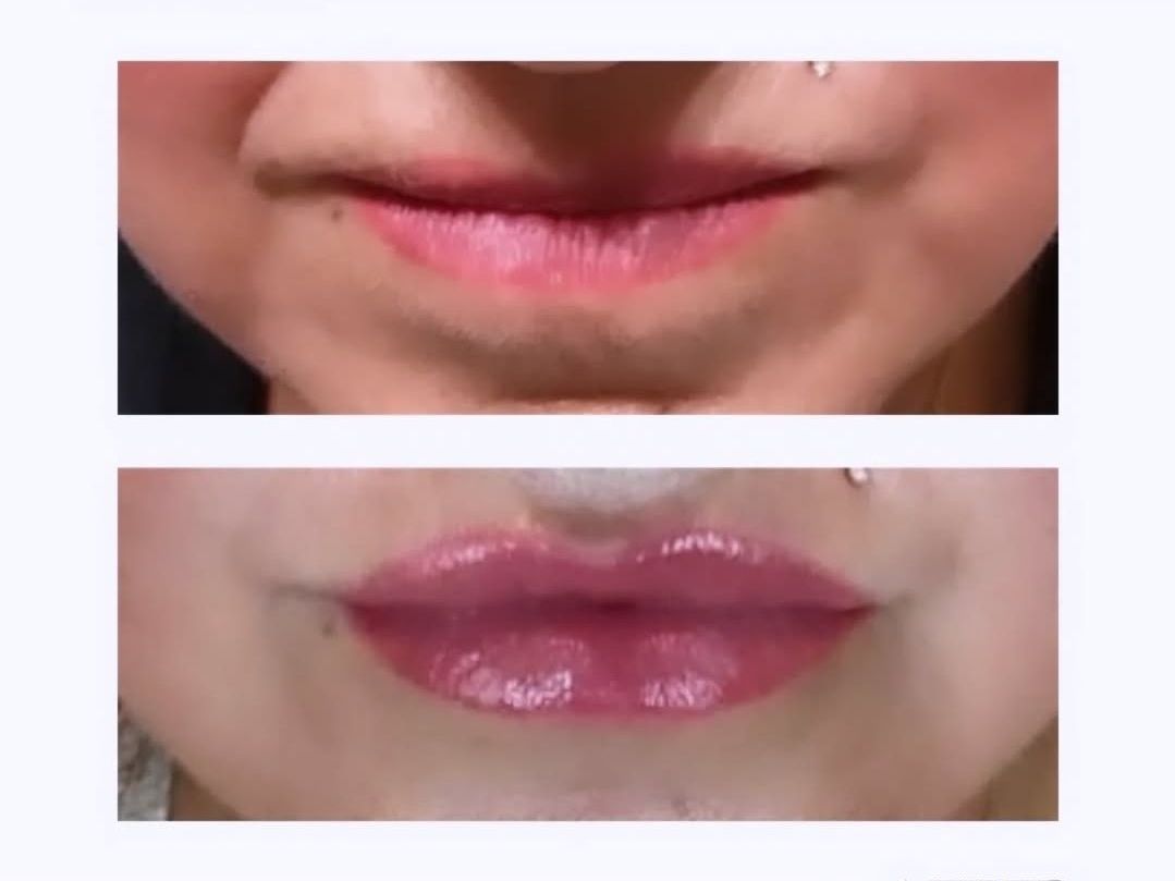 A before and after picture of a woman 's lips.