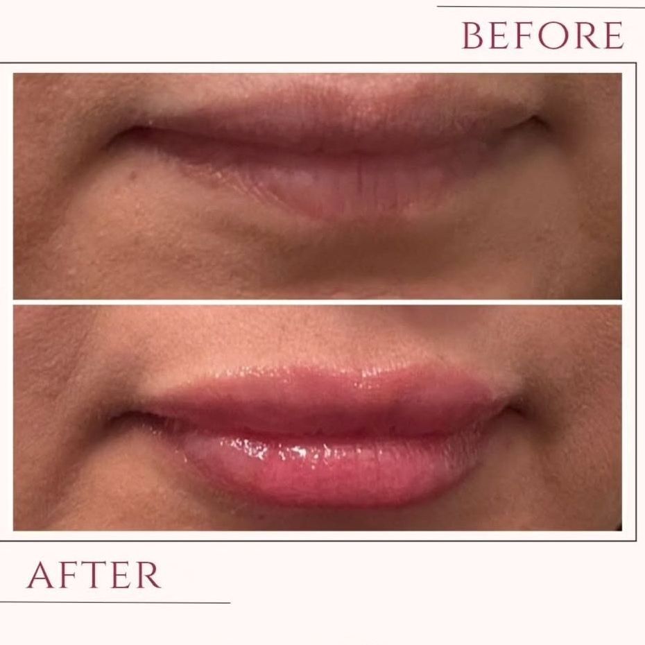 A before and after photo of a woman 's lips.