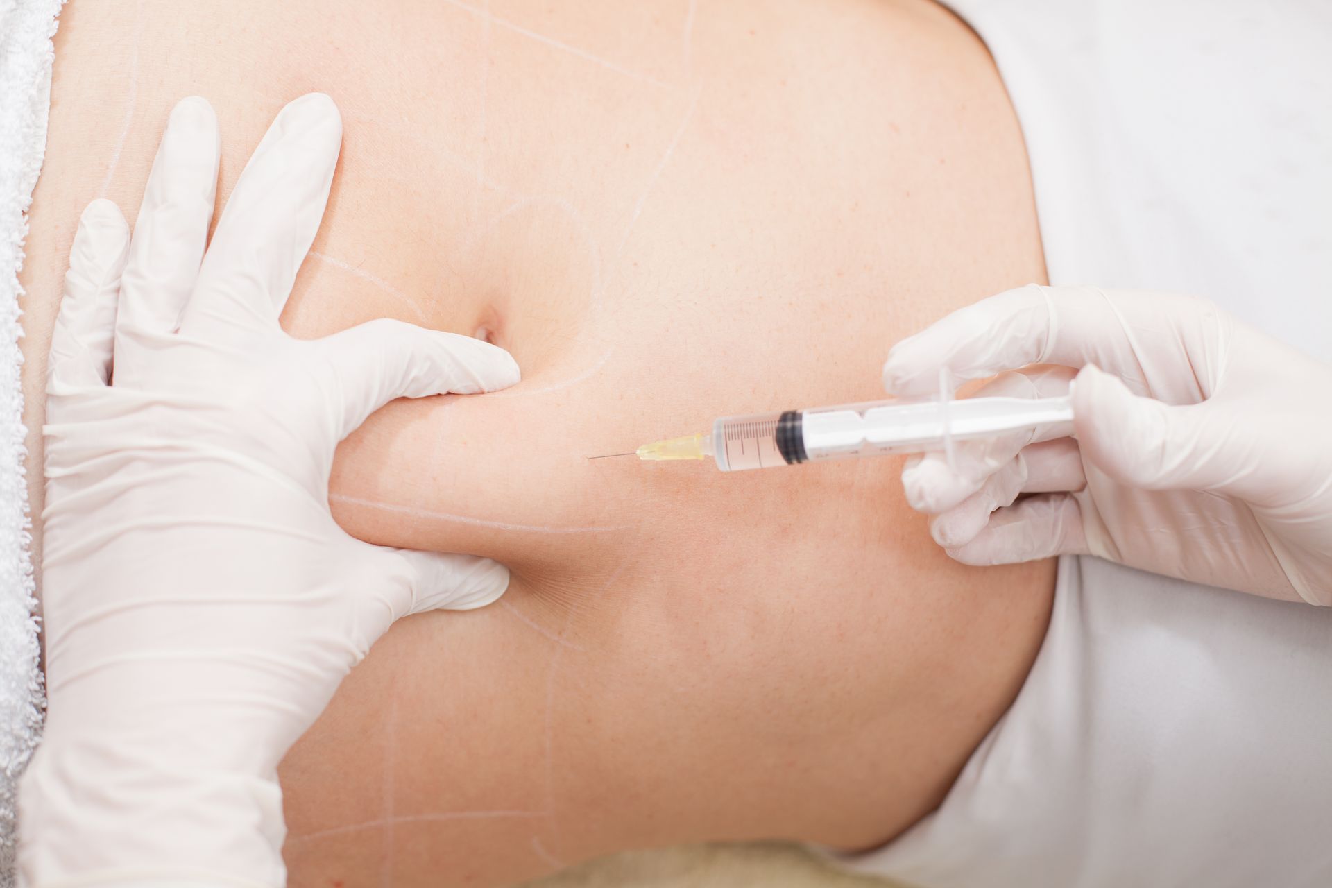 Gloved hands injecting a syringe into a person's upper arm during a medical procedure