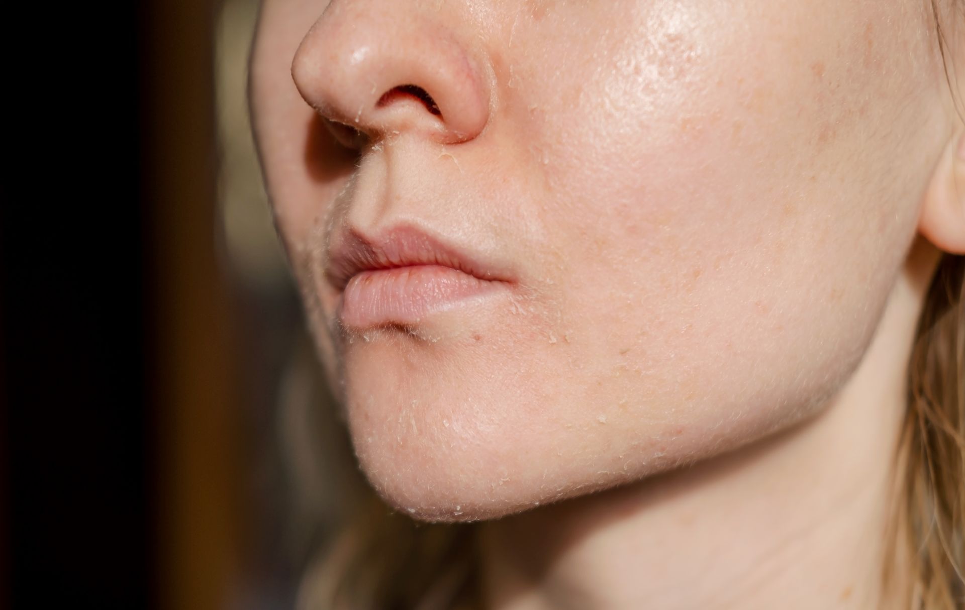Close-up of a person's lower face and cheek with natural skin texture against a dark background