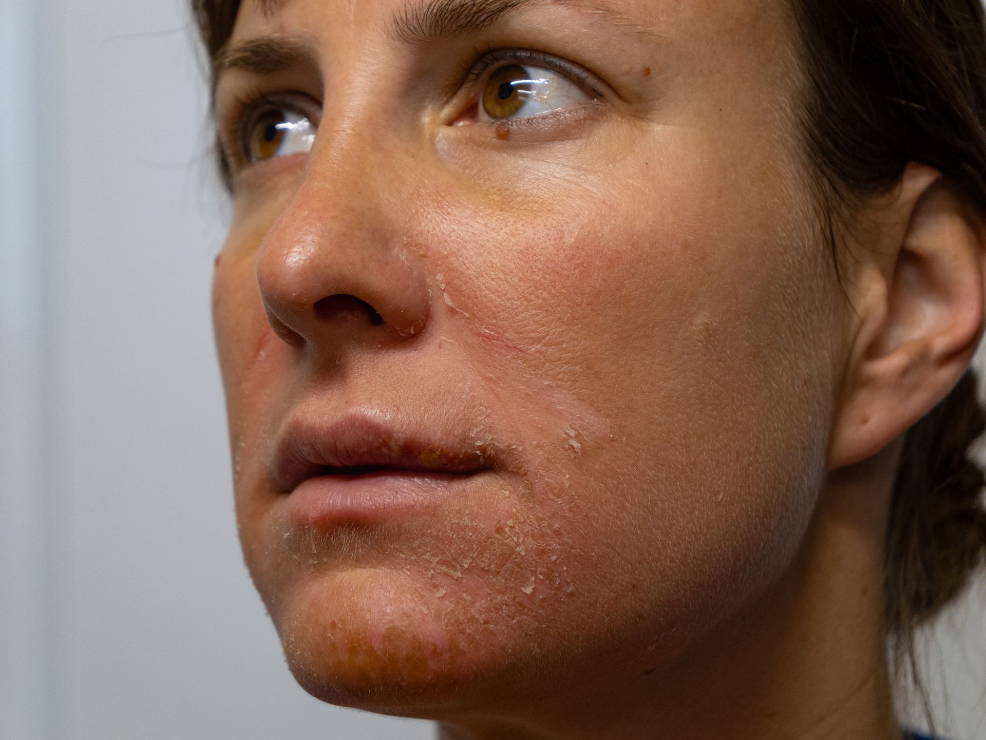 Close-up of a person with flushed cheeks, gazing upward with hands on their face in warm light
