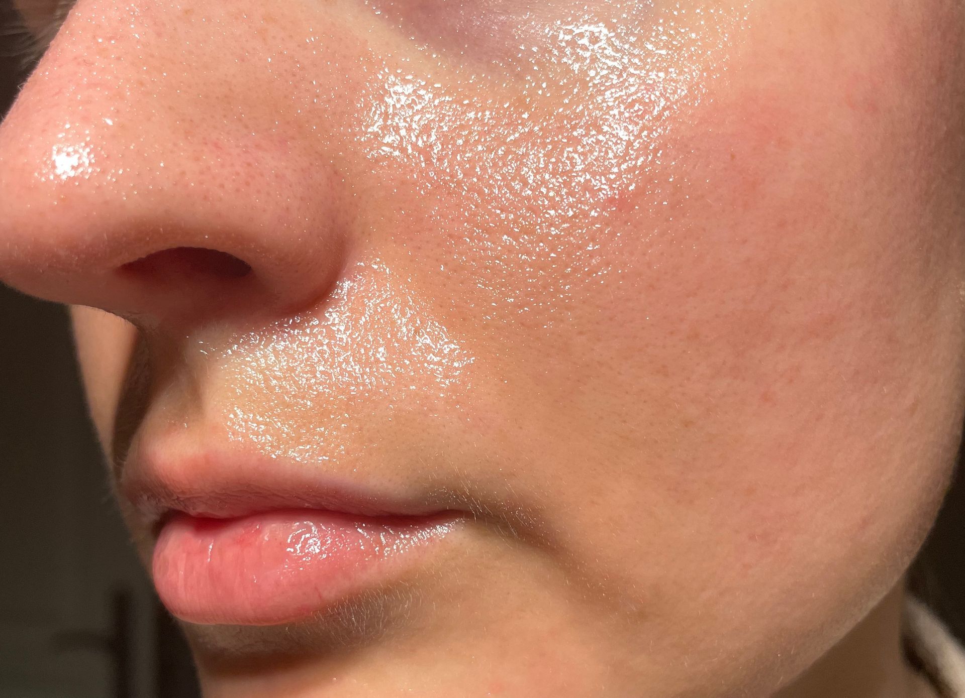 Close-up of a shiny cheek, nose, and lips in warm sunlight