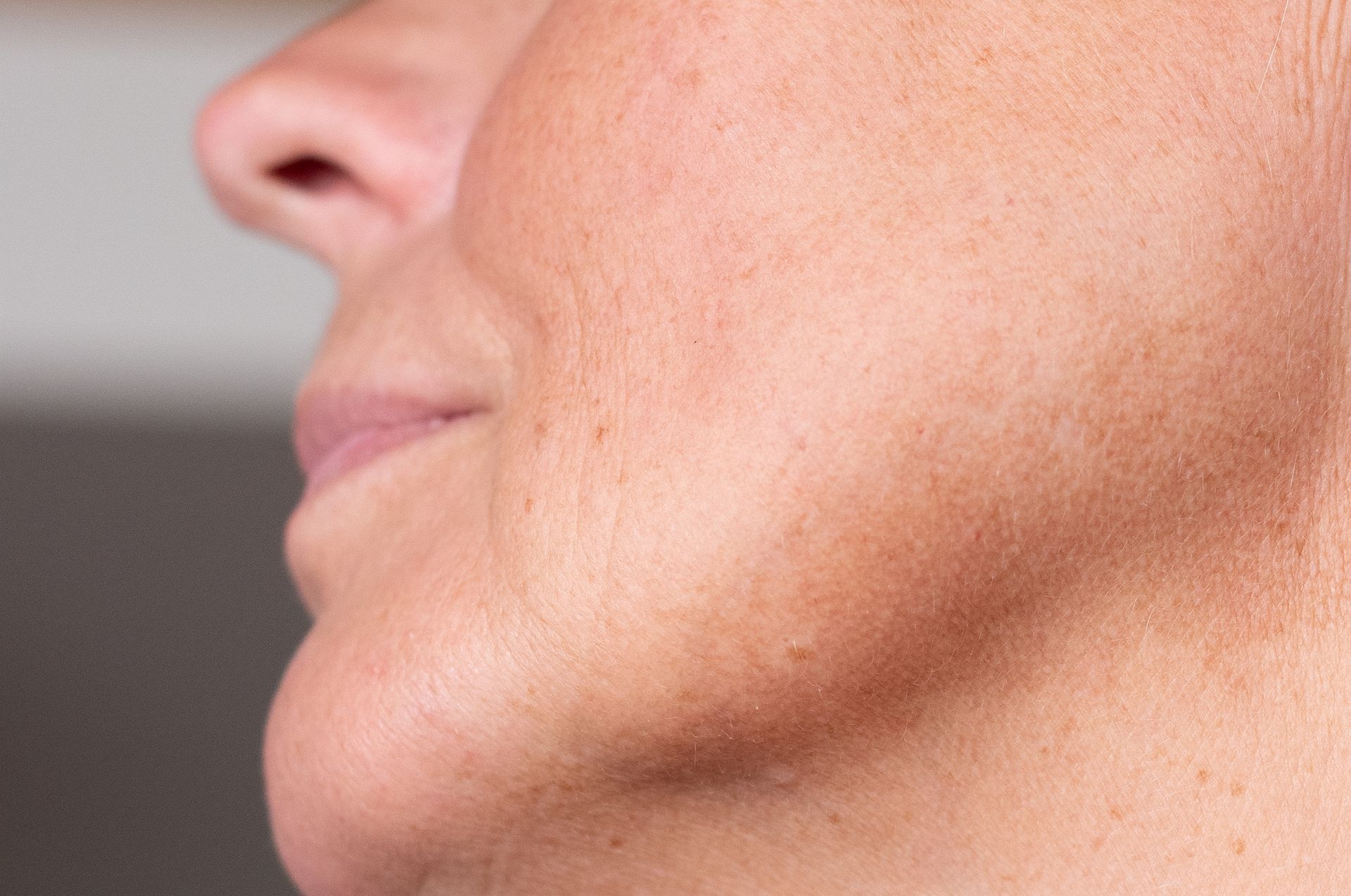 Side profile of a person’s lower face and neck, showing a visible jawline and skin contour.