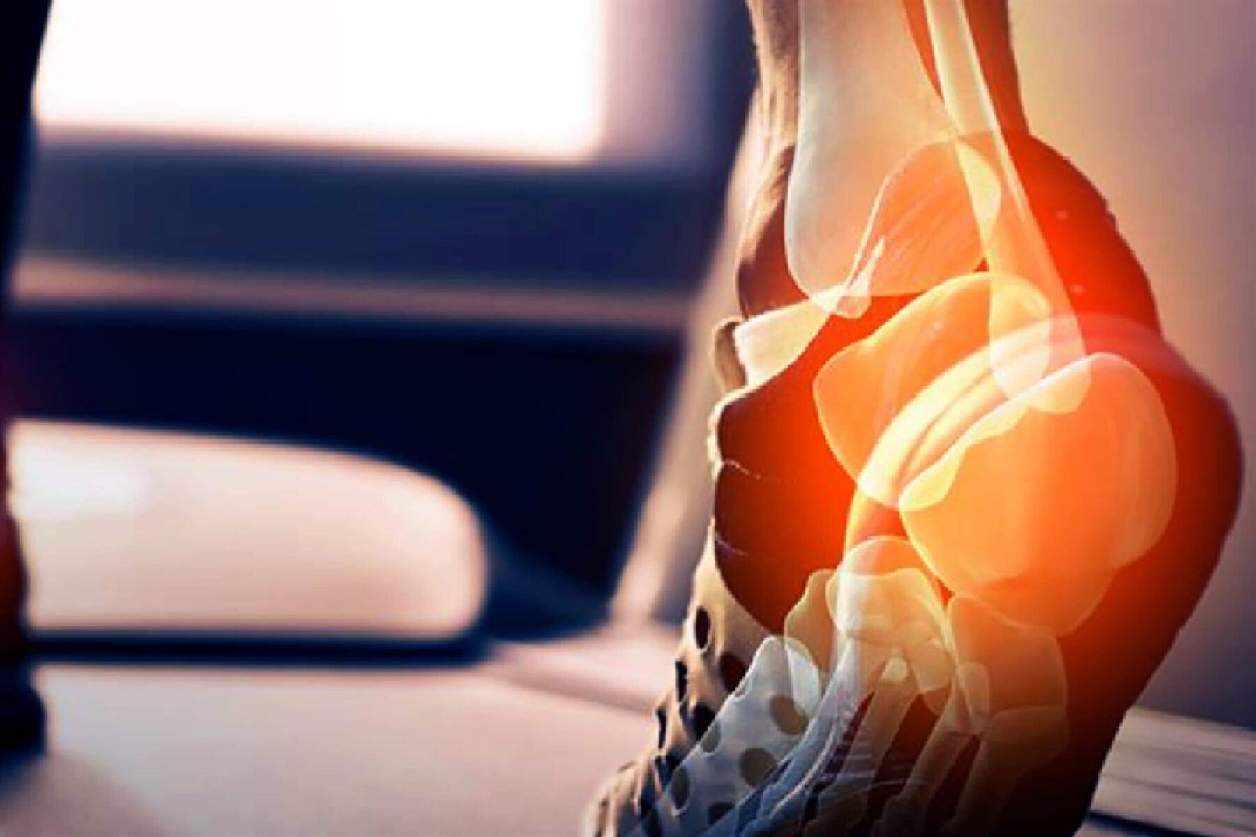 DR. ELIUT DEHESA CORTES - TENDINITIS DE AQUILES