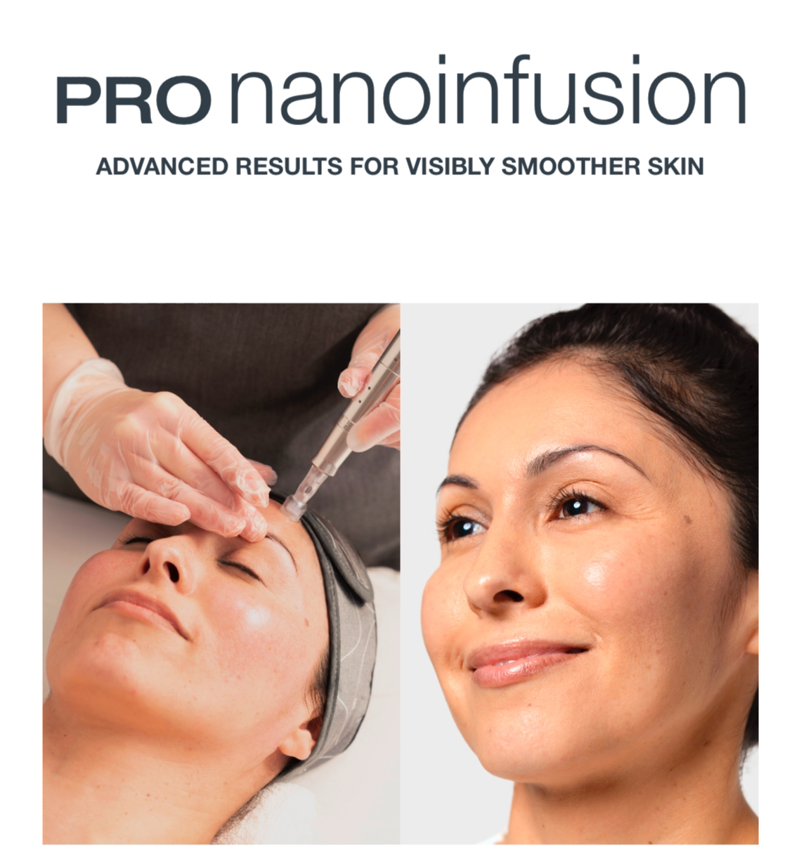 Pro nanoinfusion advanced results for visibly smoother skin