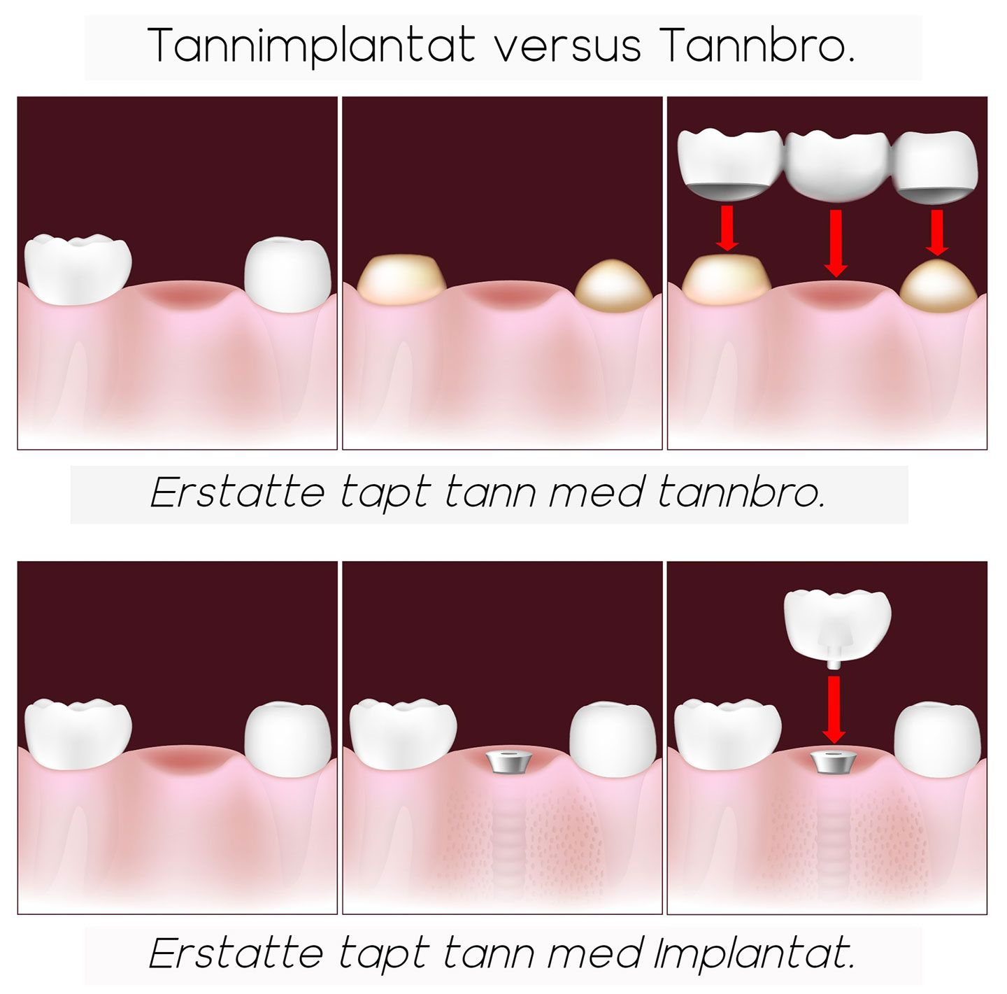 Tannkirurgi Dental Norge