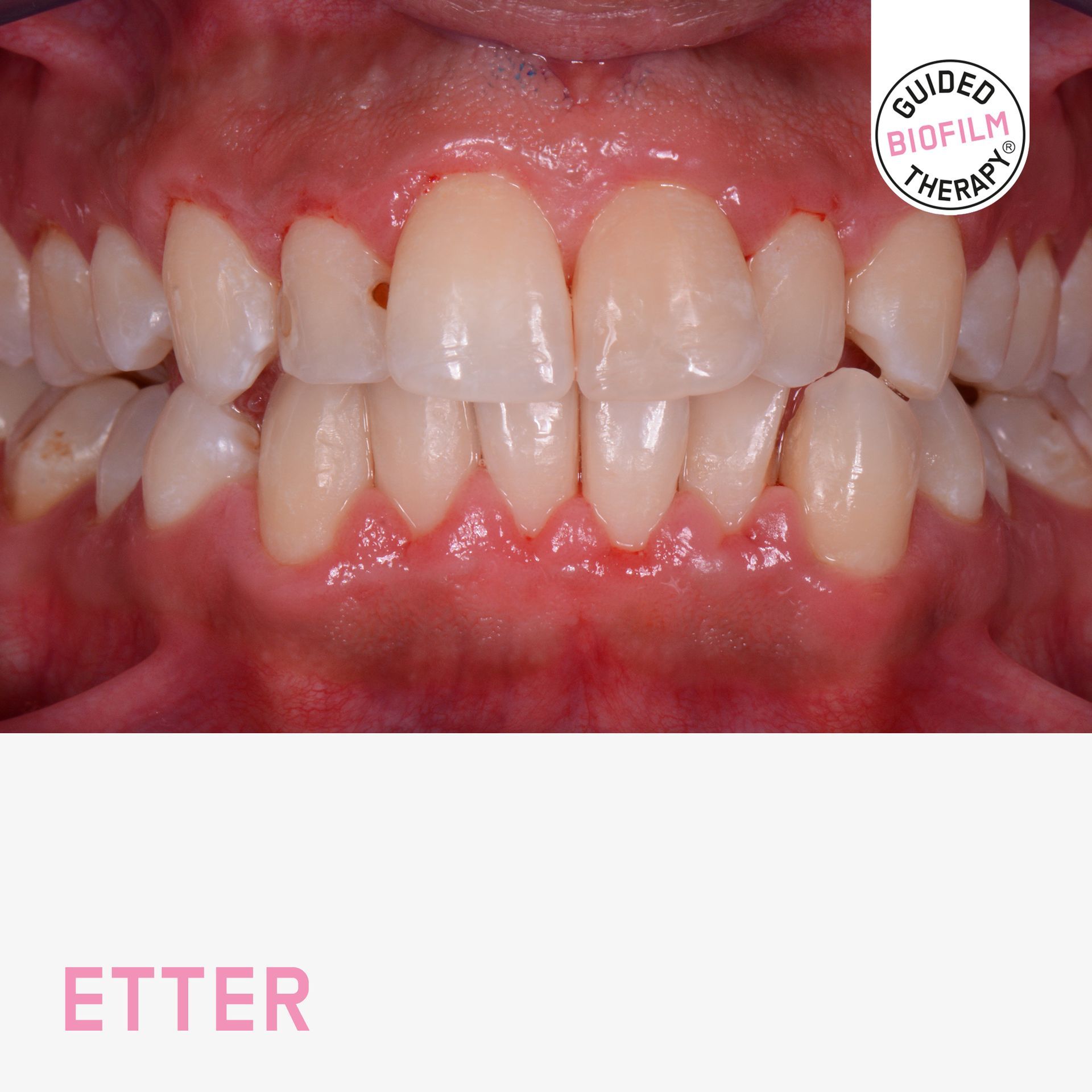 Tannbleking Dental Norge