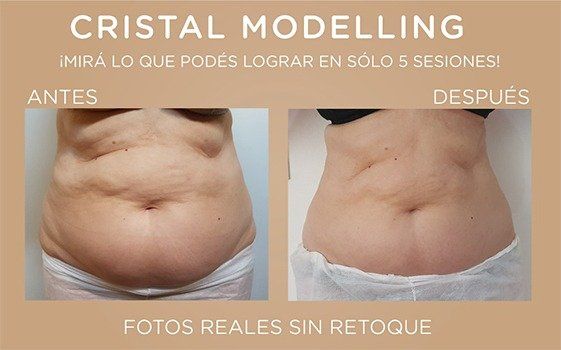 Servicio de spa