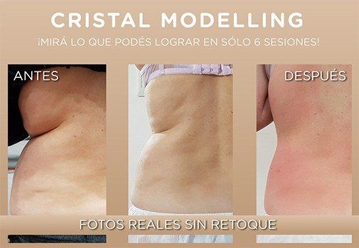 Servicio de spa