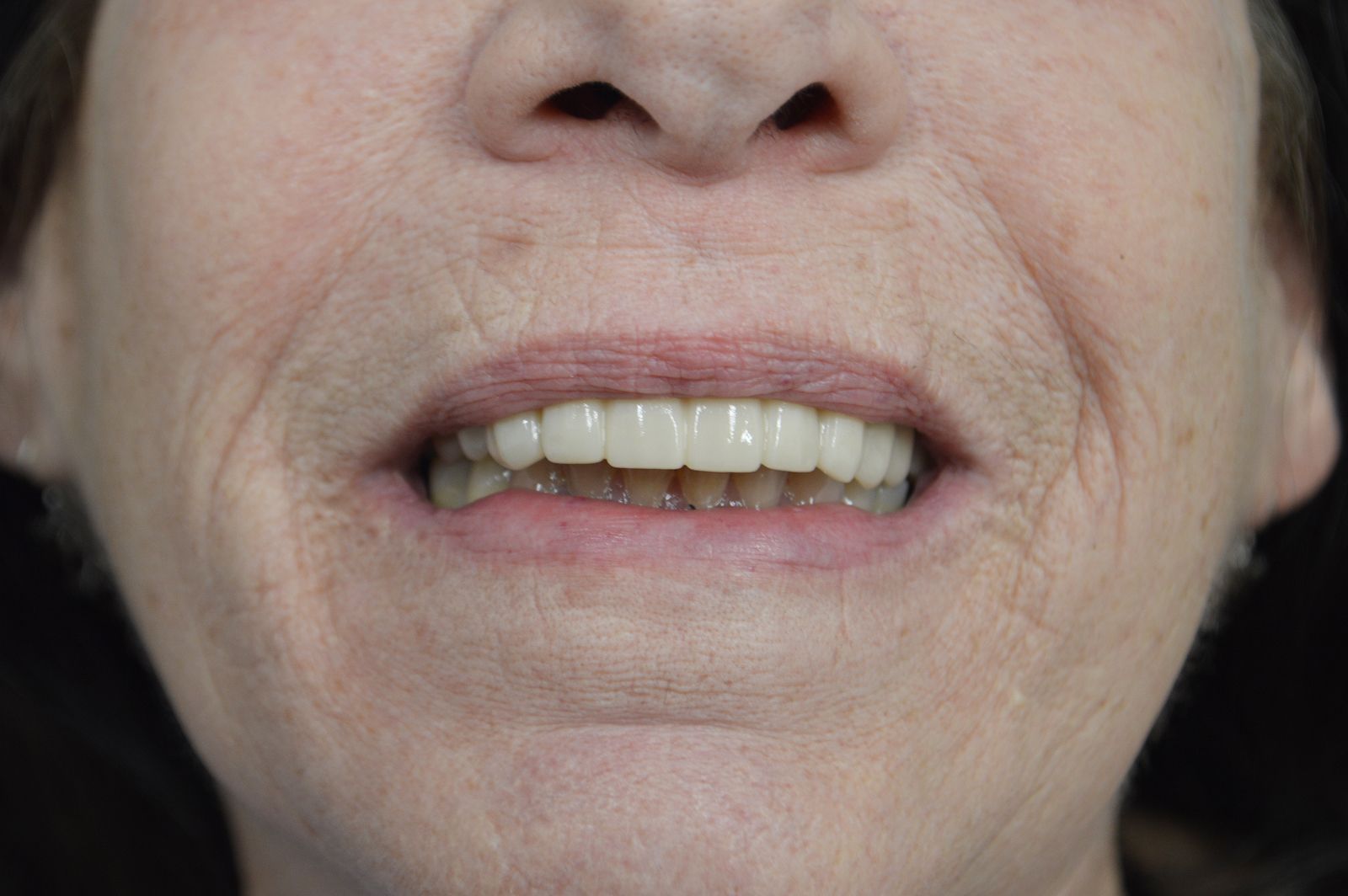 Close-up of a person’s mouth with slightly parted lips, showing teeth and wrinkles around the lips