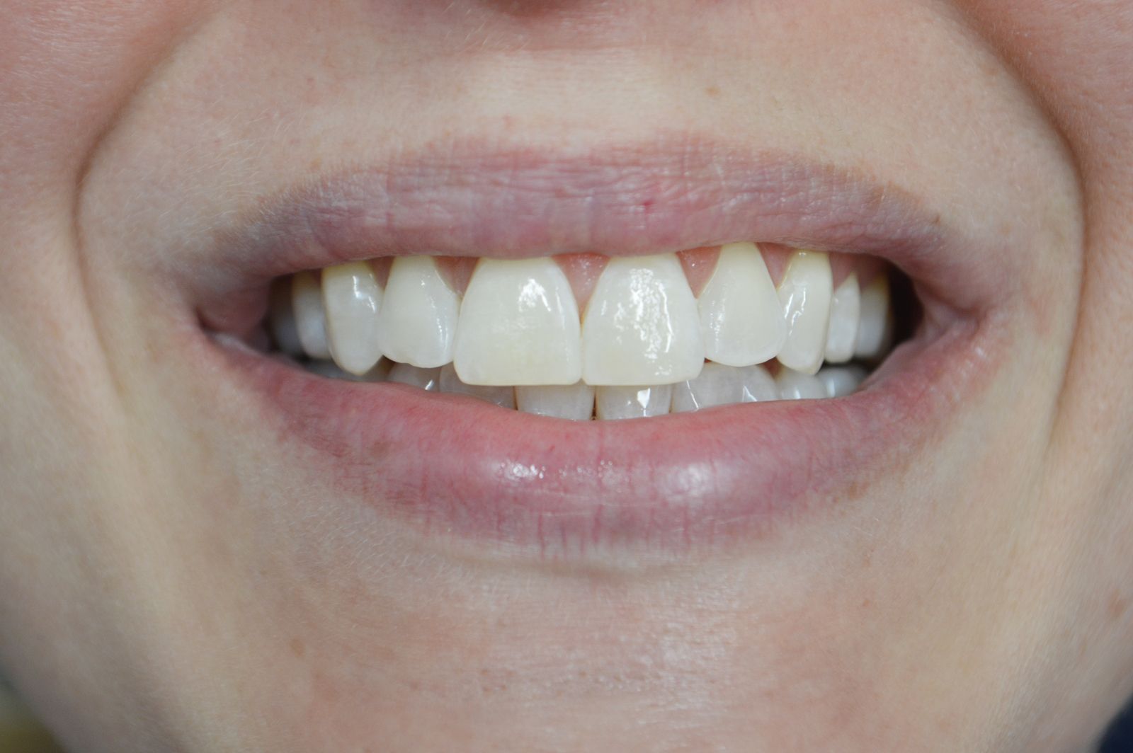 Close-up of a smiling mouth showing teeth and lips