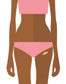 Figure of a person wearing a pink crop top and underwear; a bandage is on the hip.