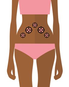 Silhouette of a person with target symbols on their abdomen, indicating a medical procedure or condition.