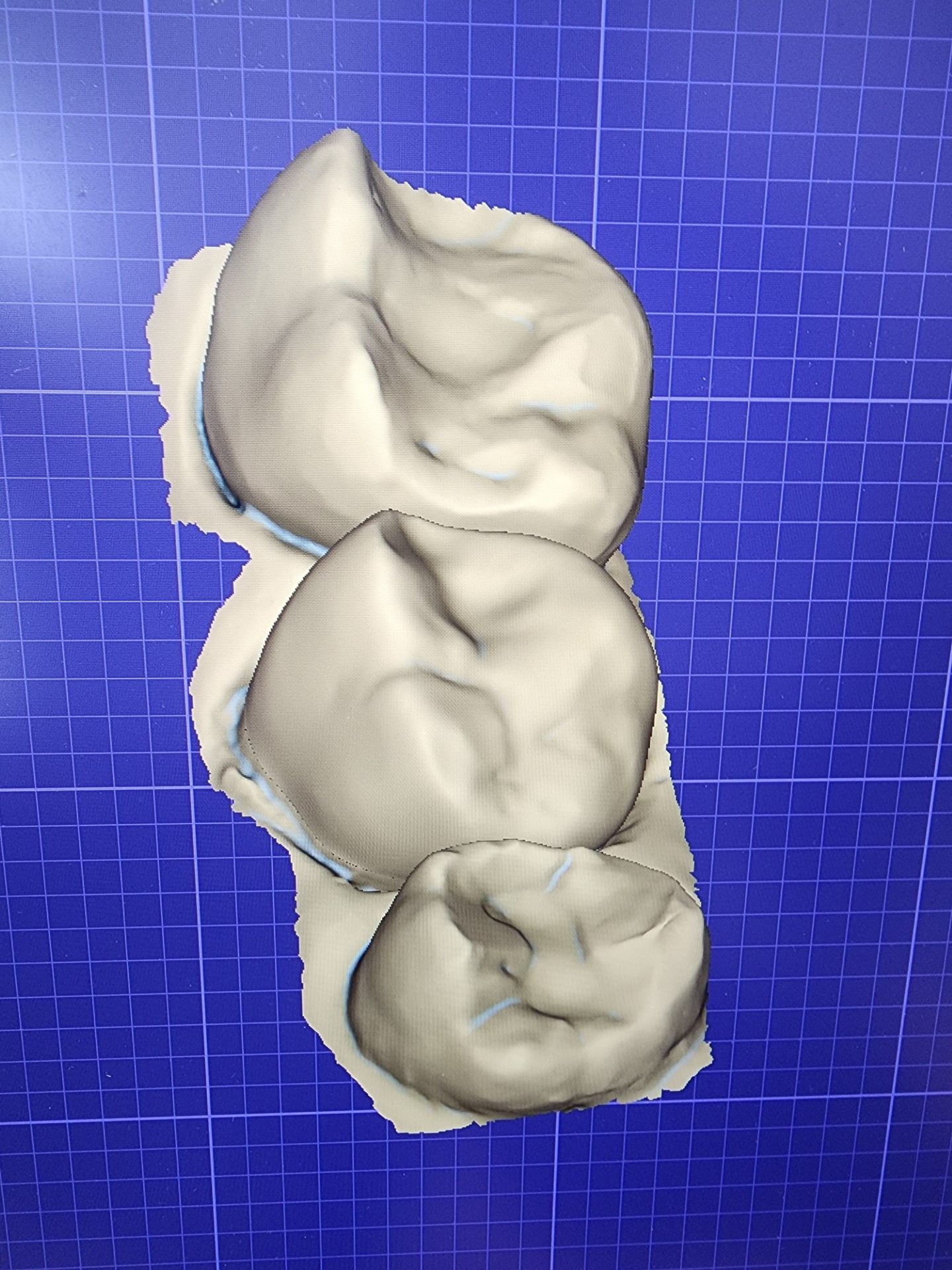 a 3d model of teeth on a blue background