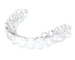 Clear Aligners