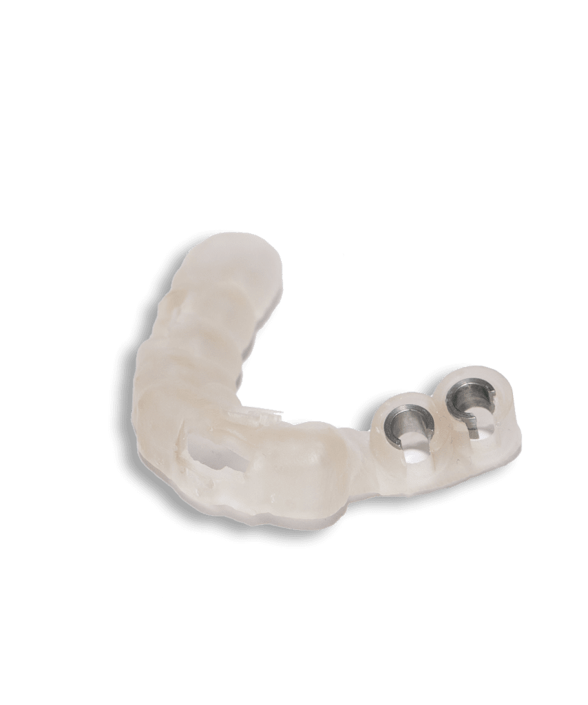 implant surgical planning