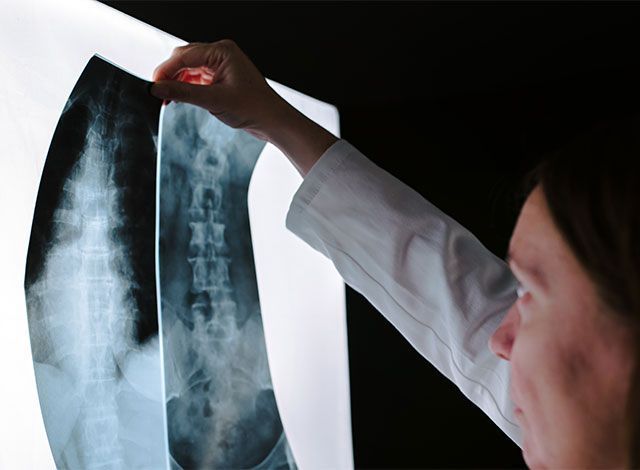 Woman smiling during a mammogram; healthcare worker assists.