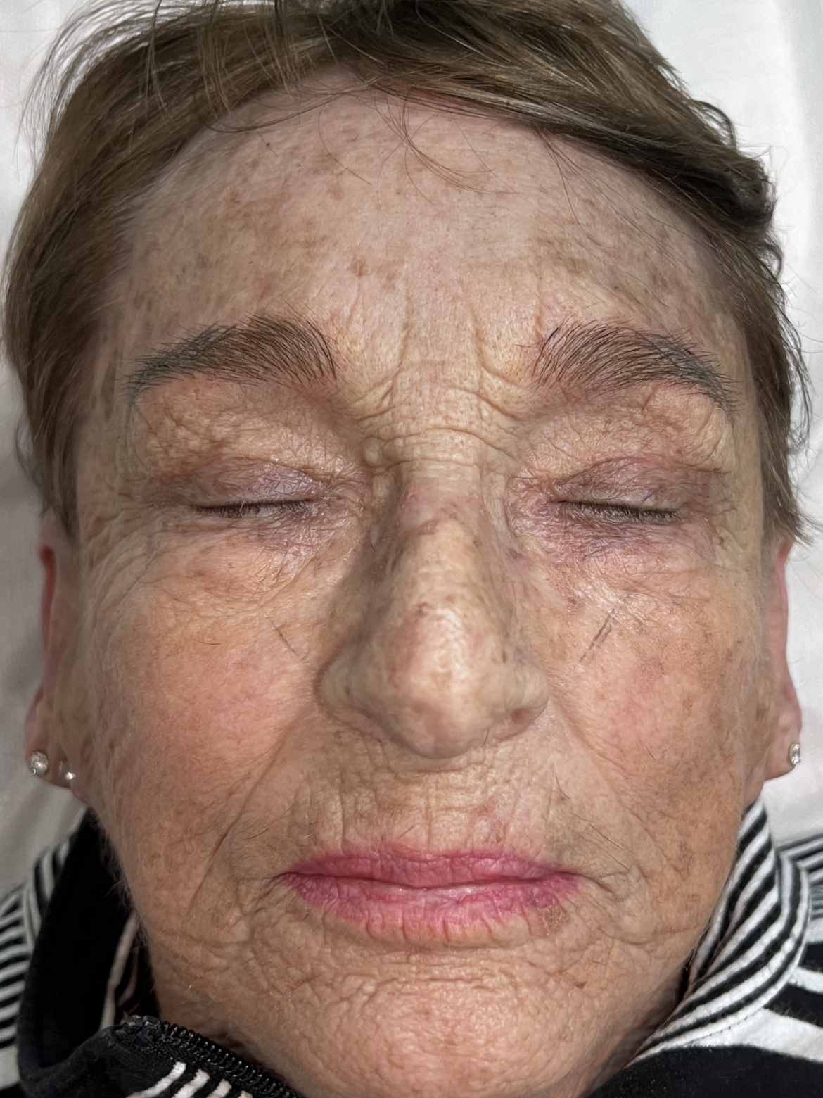 A close up of an elderly woman 's face with her eyes closed.
