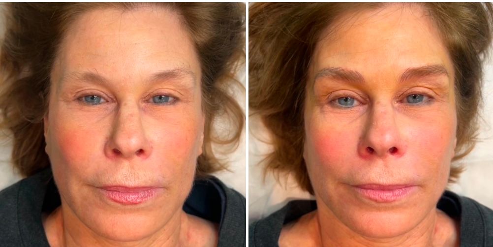 A before and after photo of a woman 's face with and without makeup.