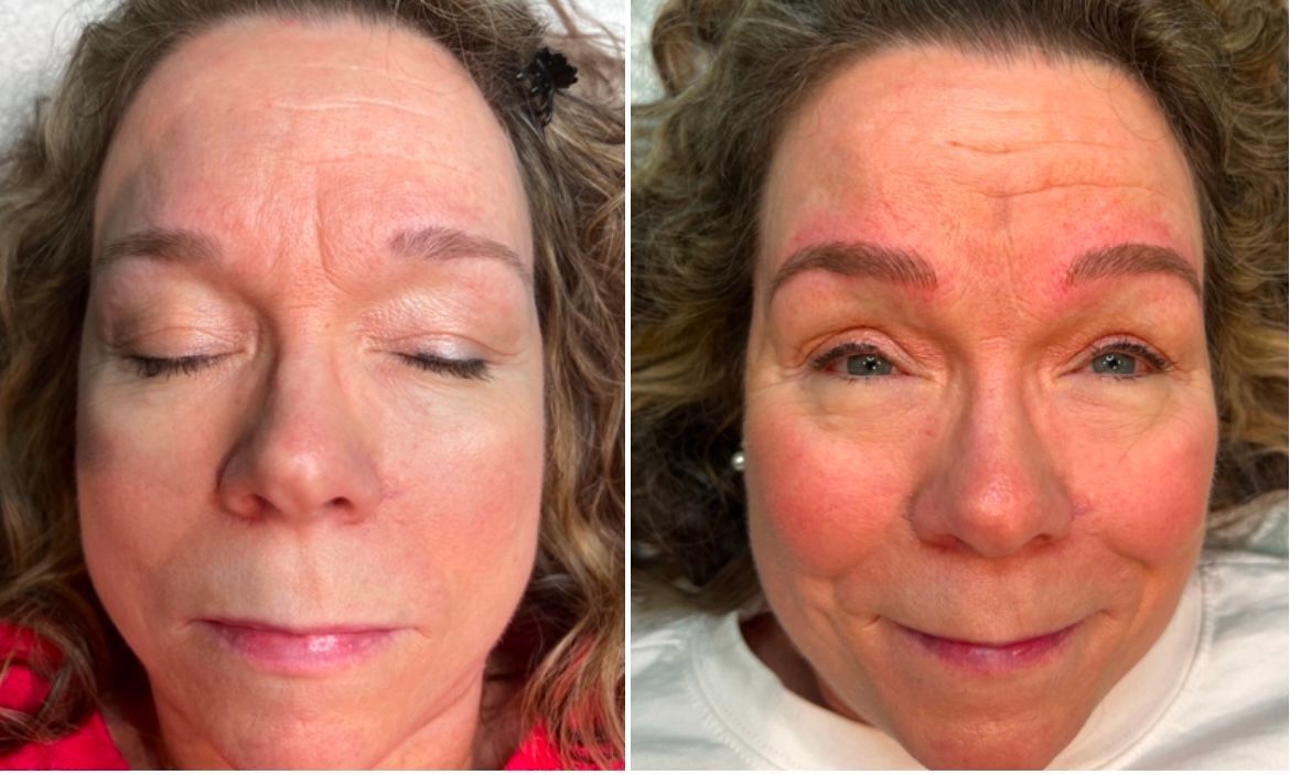 A before and after photo of a woman 's face.