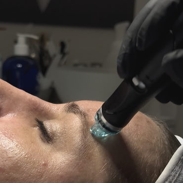 Person erhält Gesichtsbehandlung, schwarz behandschuhte Hand mit Gerät mit blauer Spitze auf der Stirn.