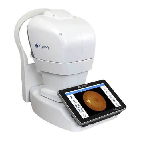 retinalyze augencheck sehtest martinaglia optik ag netzhautscan