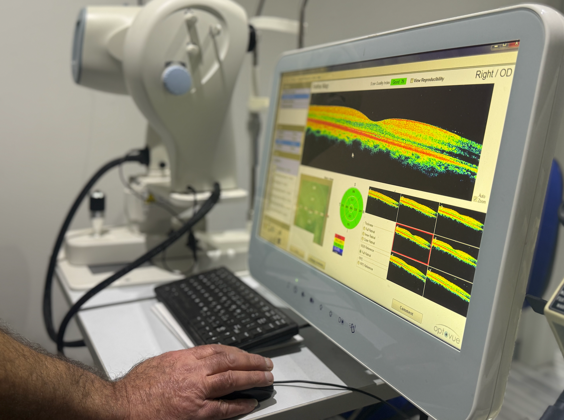 Person using an OCT machine to analyse eye scan data — Eyepower In Tahmoor, NSW