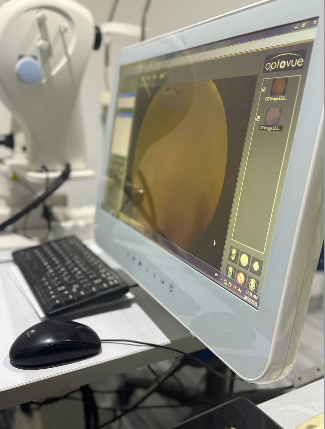 Computer screen showing an eye exam image — Eyepower In Picton, NSW