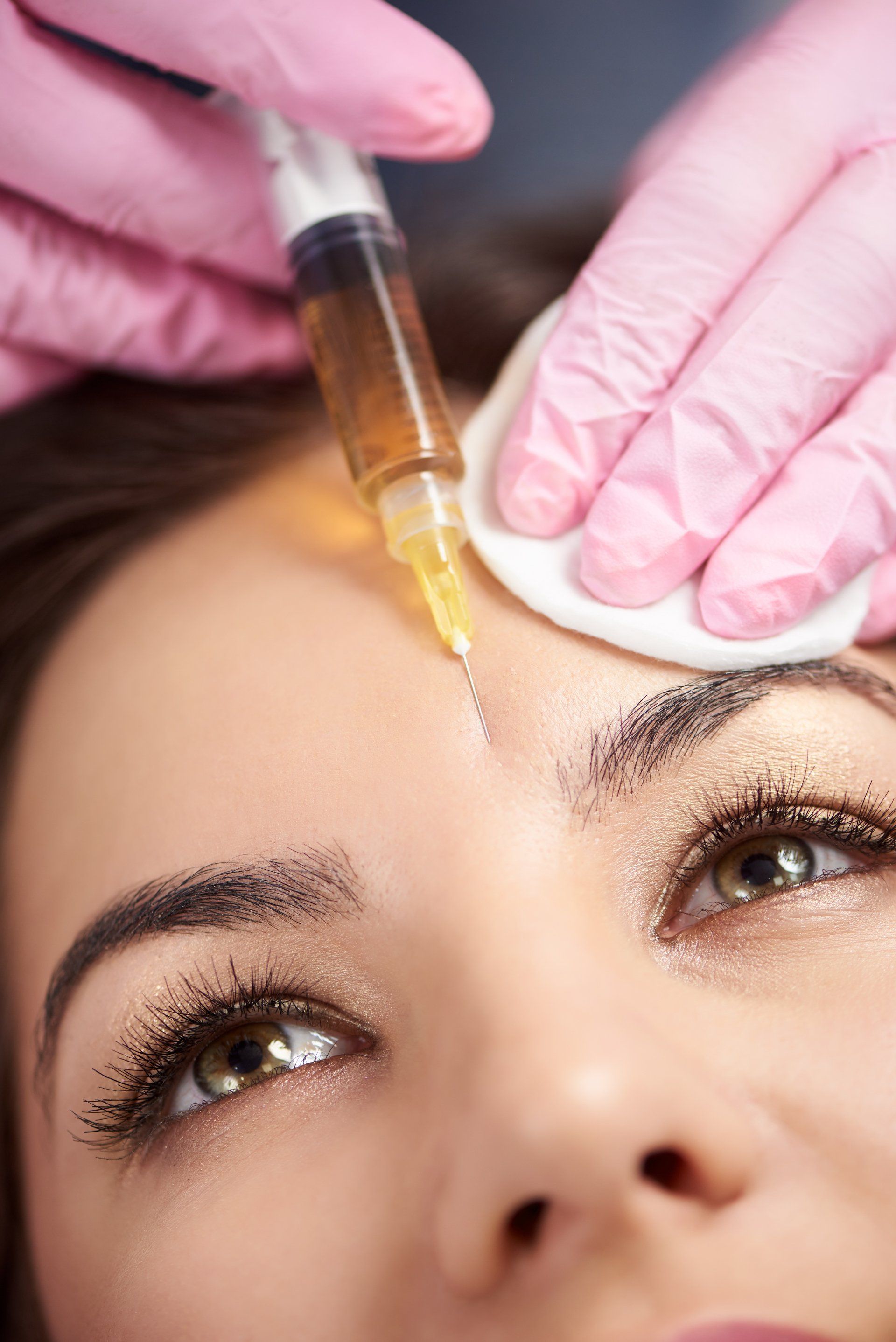 A woman is getting a botox injection in her forehead.