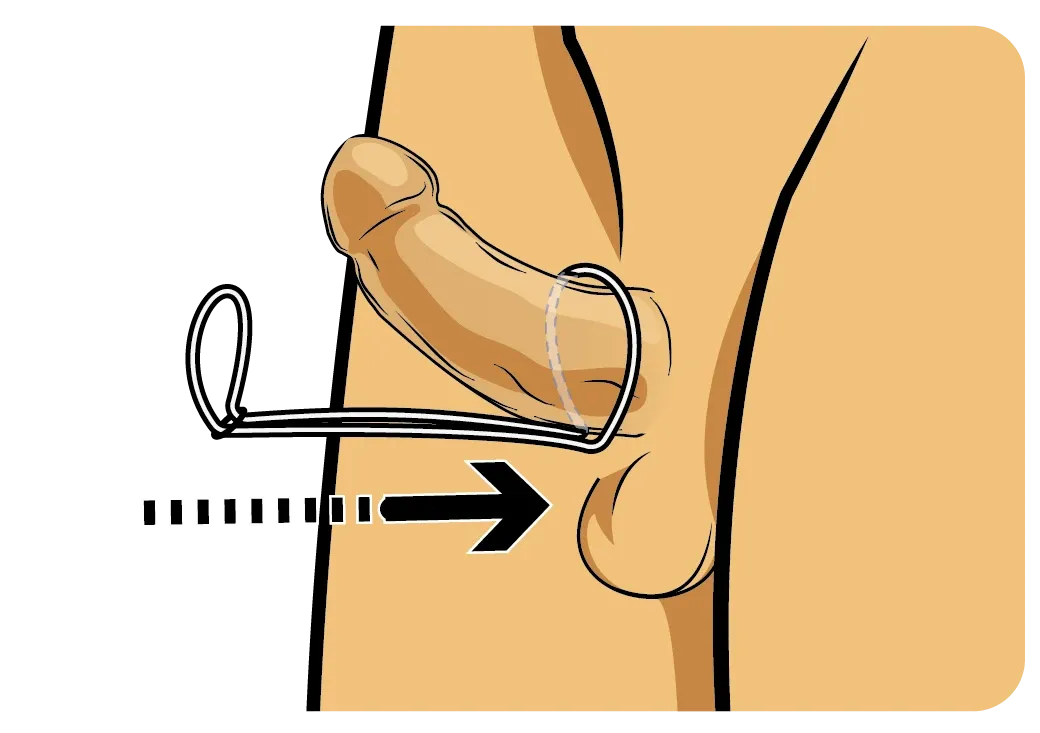 Stays Hard Fitting Instructions Step 1