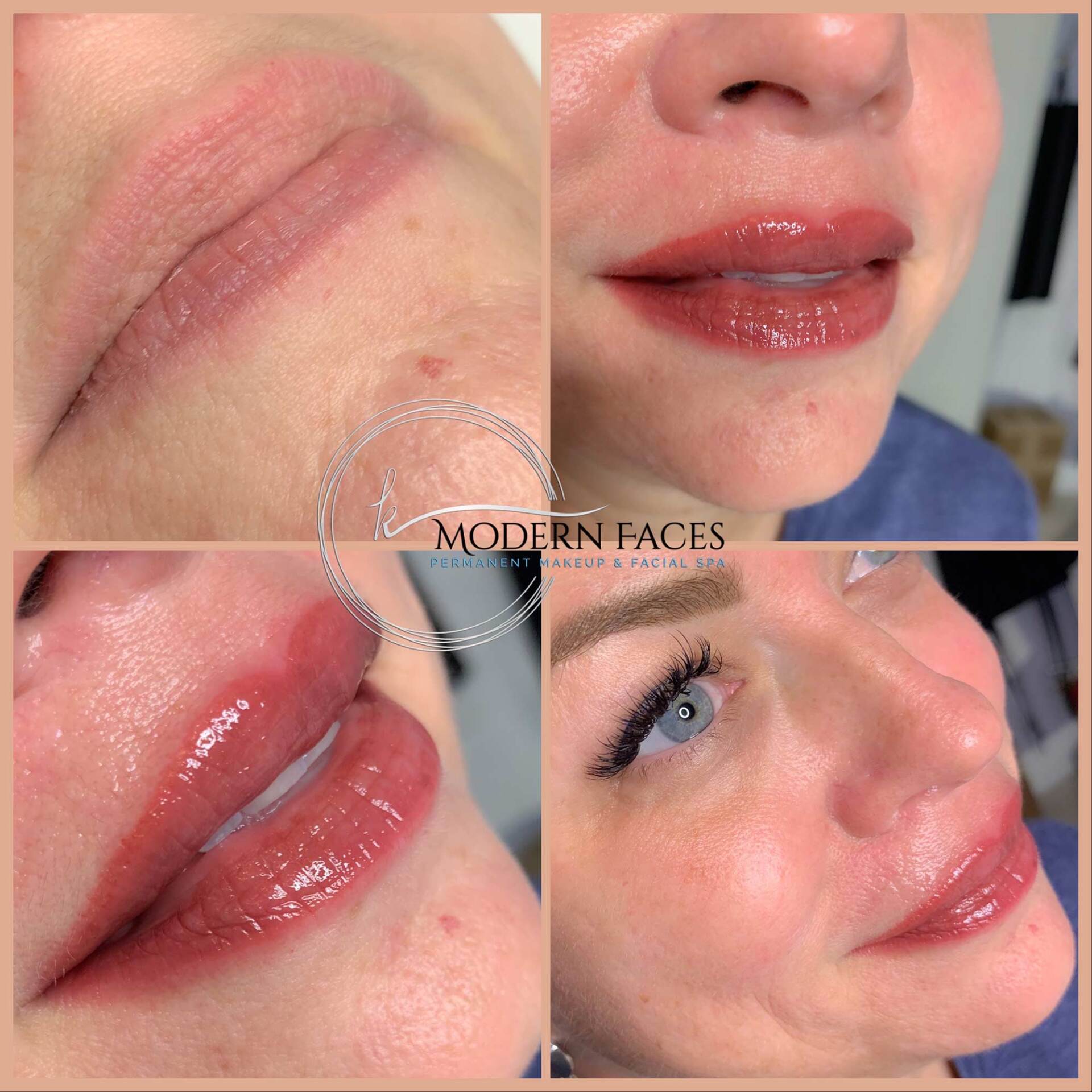 Collage of glossy pink lips and lips with subtle cosmetic enhancement, with a Modern Faces watermark