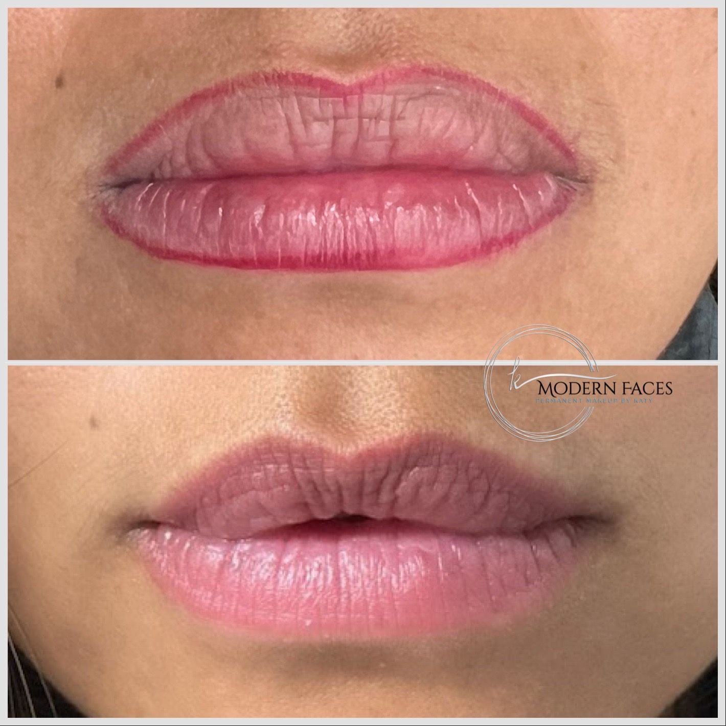 Close-up before-and-after of lips: dry, wrinkled pink lips above, smoother pink lips below.
