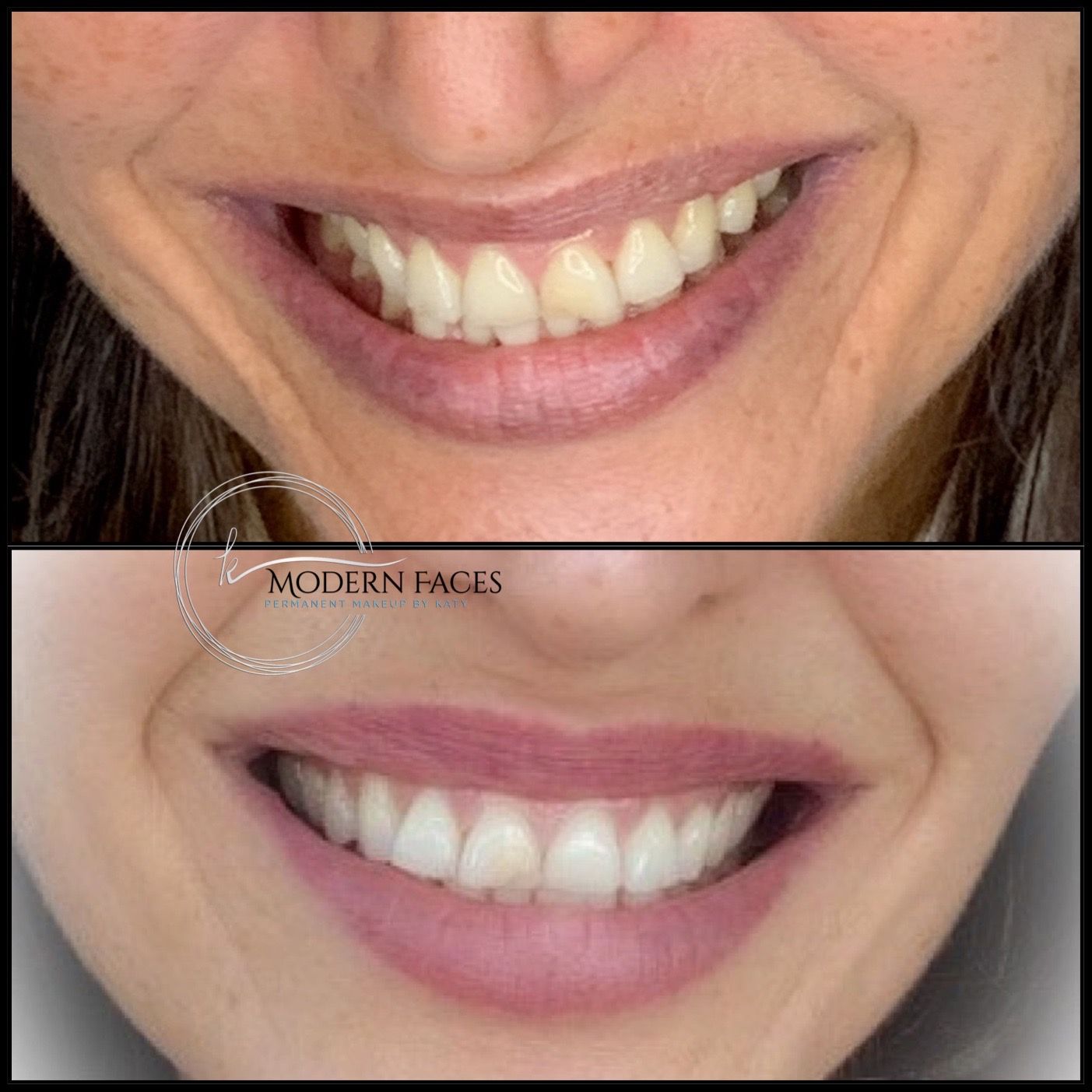 Before-and-after close-up of a smiling mouth, showing whiter teeth and pink lipstick.