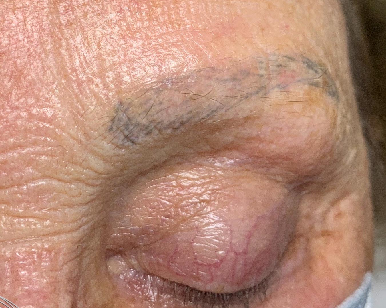 close up eyebrow