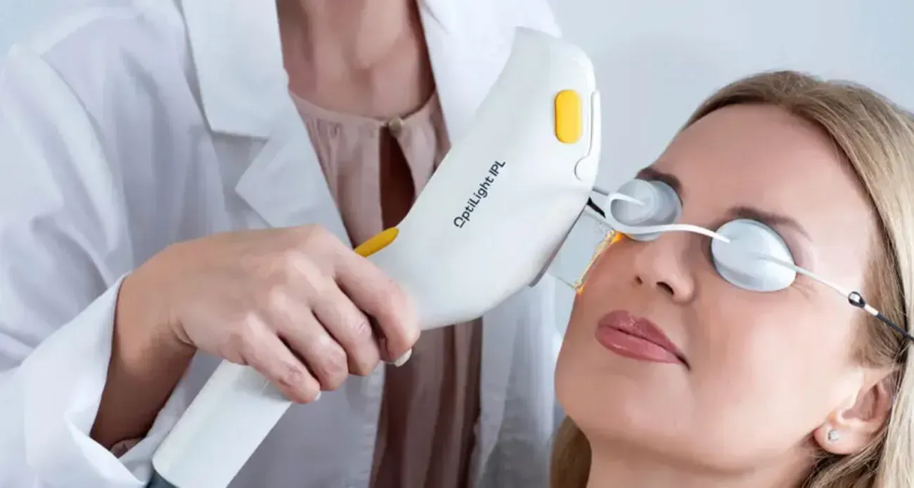 A professional uses an OptiLight device to perform IPL therapy on a patient wearing protective eye shields.