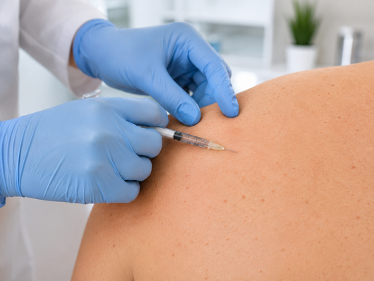 mesoterapia