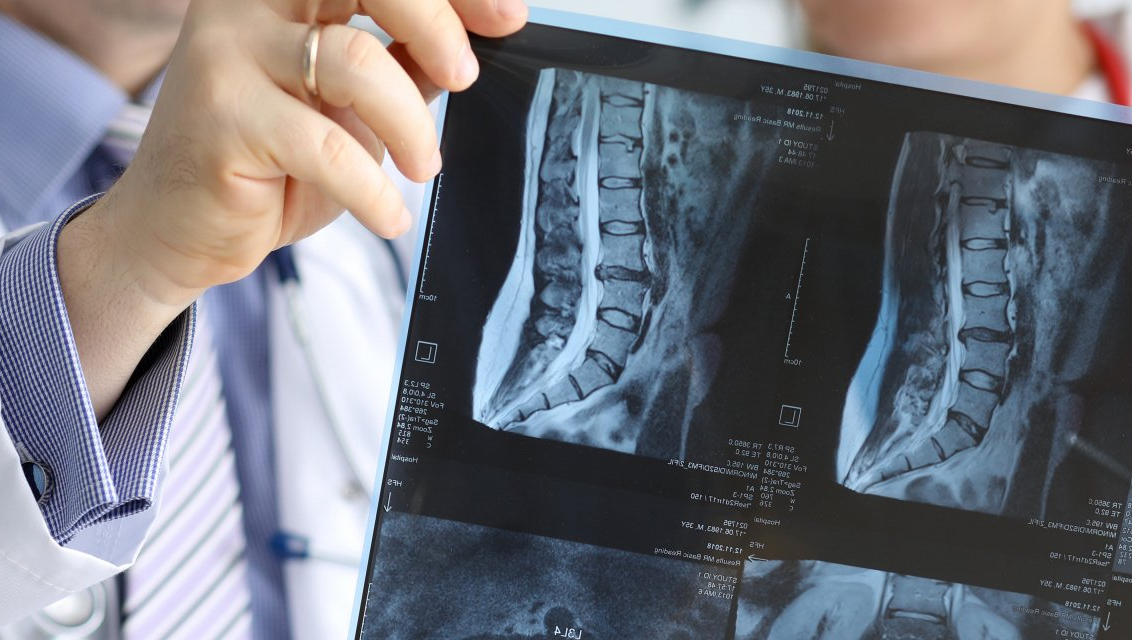 Orthopedic Imaging Baton Rouge Xray and MRI Services Baton Rouge