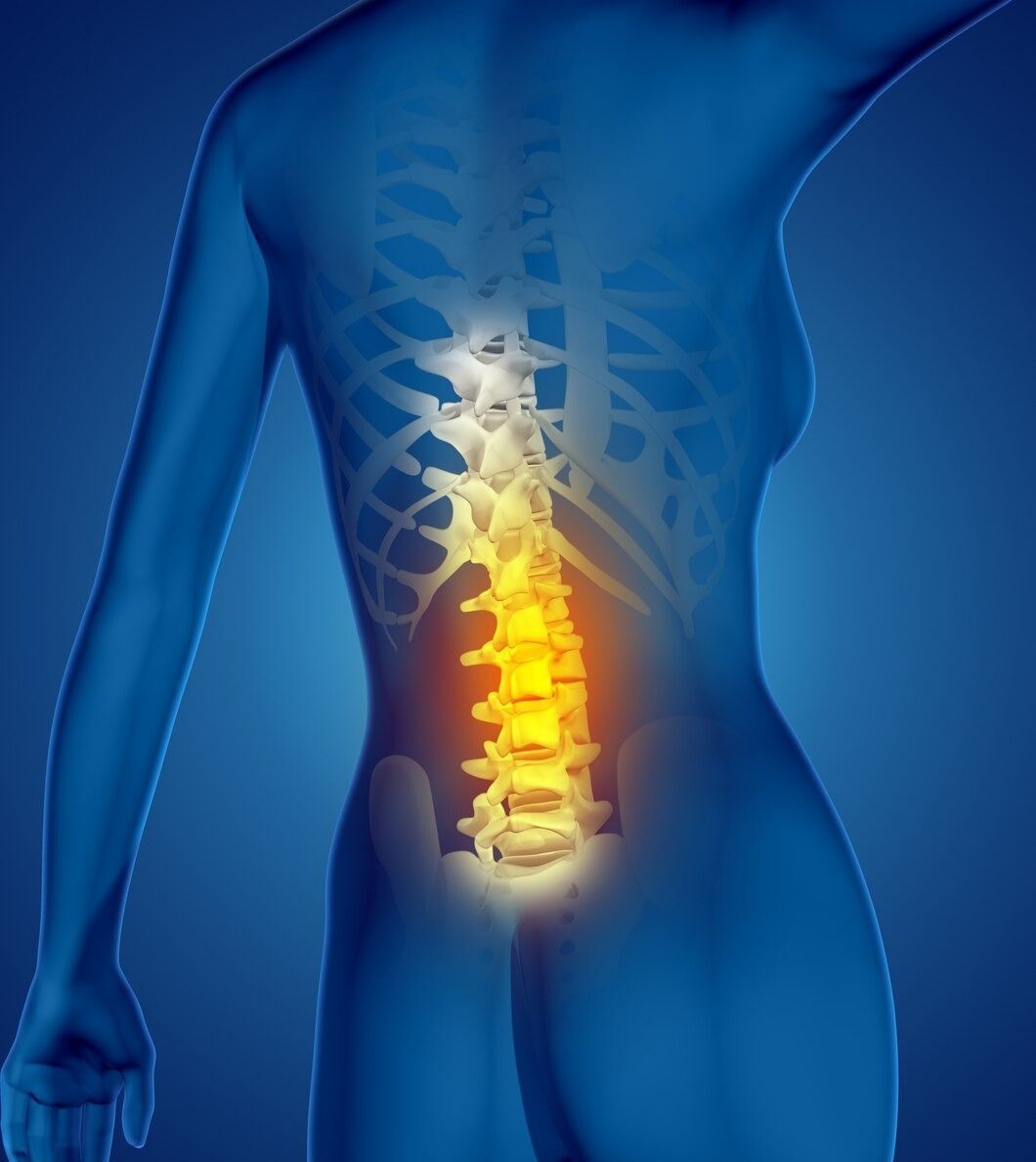 Chiropractors for  Car Accident 