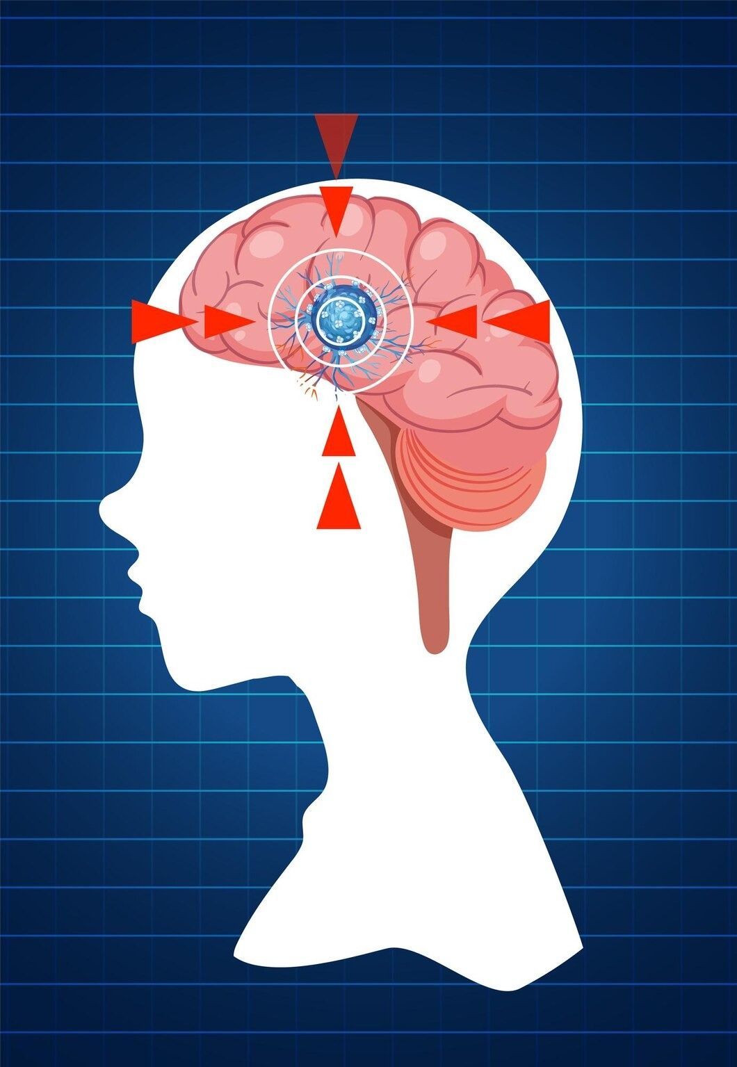 Car Accident Chiropractors in Cocoa Beach, FL
