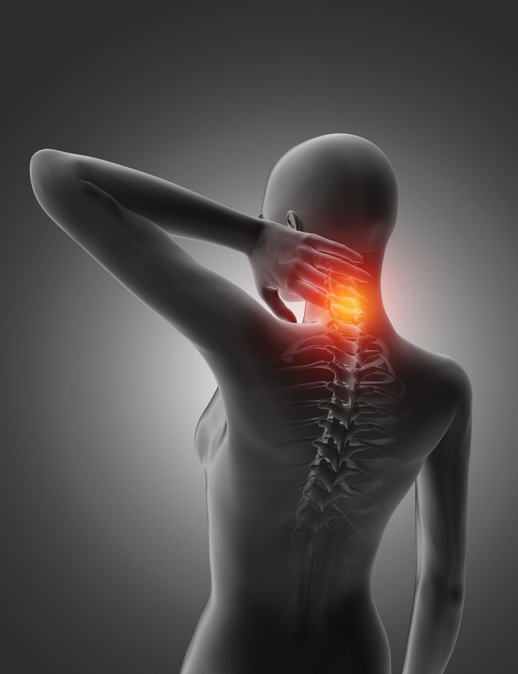 Chiropractors for  Car Accident 