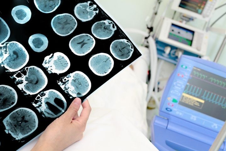 visita di neurologia