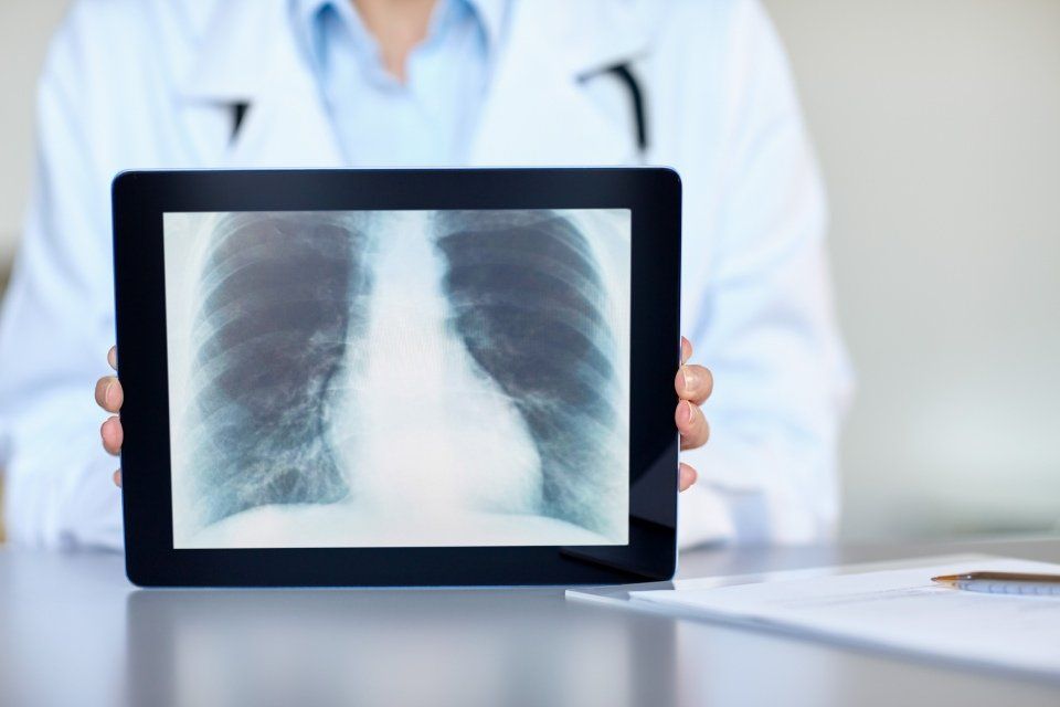 Radiografia polmoni